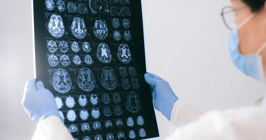 Brain MRI scans reviewed by a clinician. TB006 is an investigational drug.